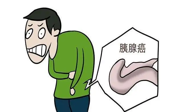 杭州御和堂中医：胰腺癌早期症状。