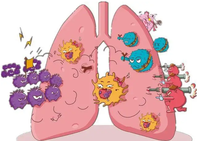 ：哪些症状在肺癌患者当中最常见？