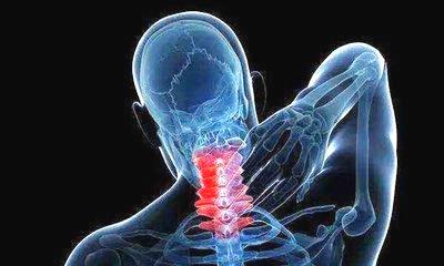 强直性脊柱炎的三大致病因素