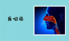 中医对鼻咽癌有什么特殊的理解？